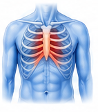 Costochondritis