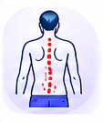 Scoliosis