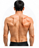 Scapular Winging
