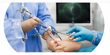 Arthroscopy Recovery