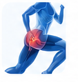 Hip Flexor Strain