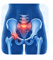Pelvic Girdle Pain
