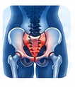 Sacroiliac Joint Dysfunction
